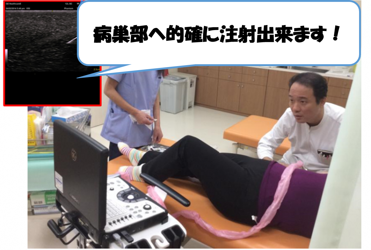くろしま整形外科　エコー